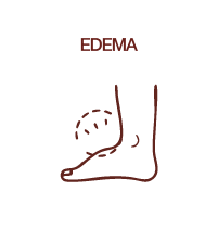 EDEMA