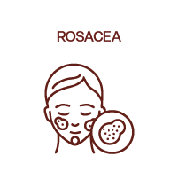 Rosacea