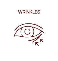 Wrinkles