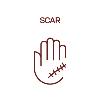 Scar