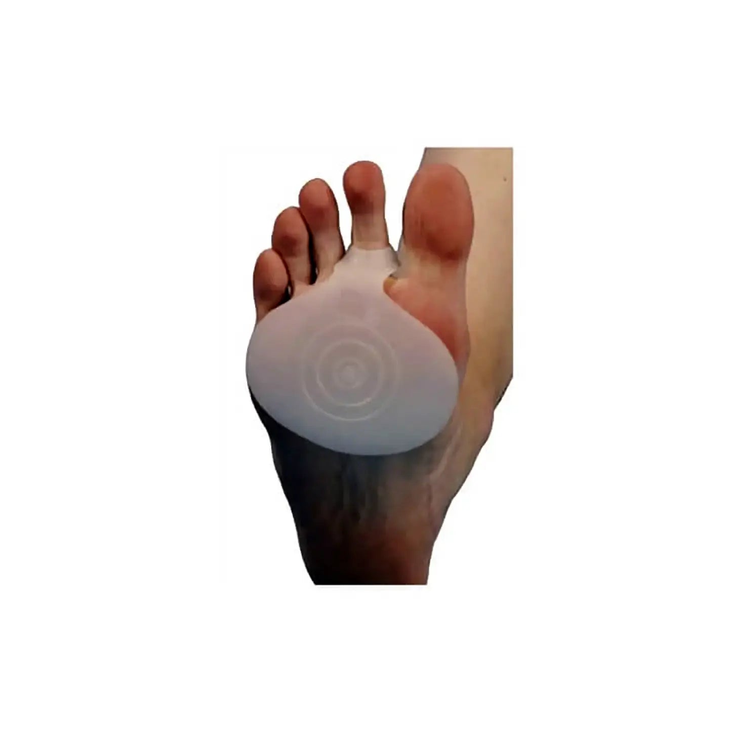 Tynor Metatarsal Pad Silicone K08 [Universal size]