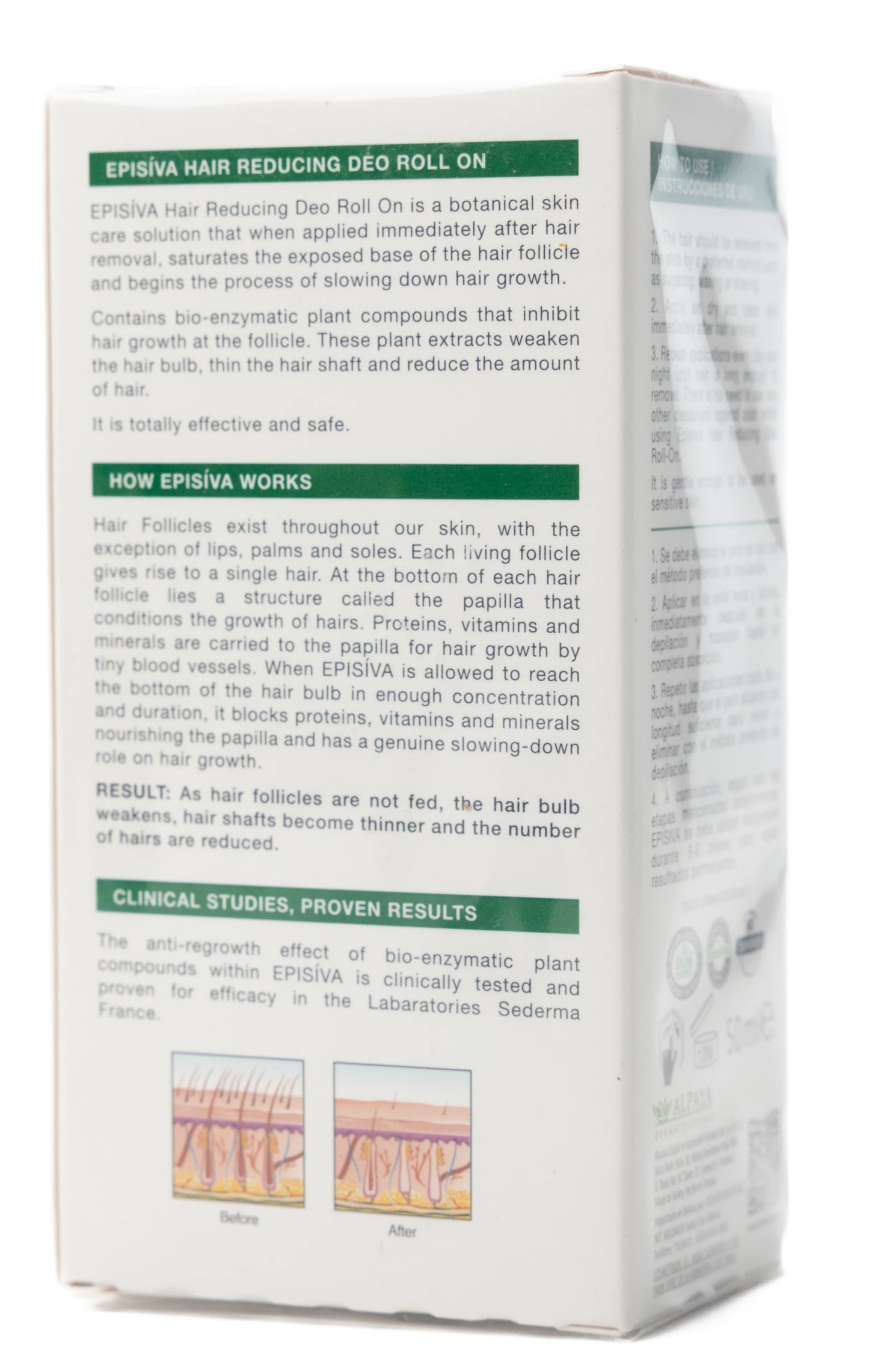 Episiva Stop Hair Growth Deo Roll-On for Women 50 Ml