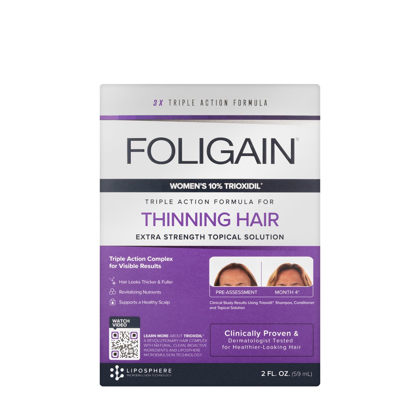 Foligain Women's 10% Trioxidil Extra Strength Topical Solution for Thinning Hair 59 Ml
